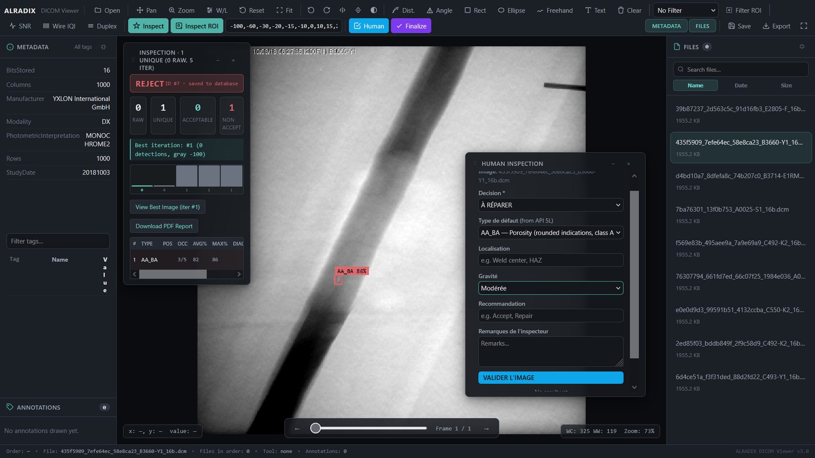 ALRADIX DICOM viewer